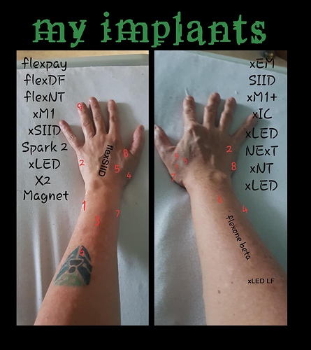 myimplants