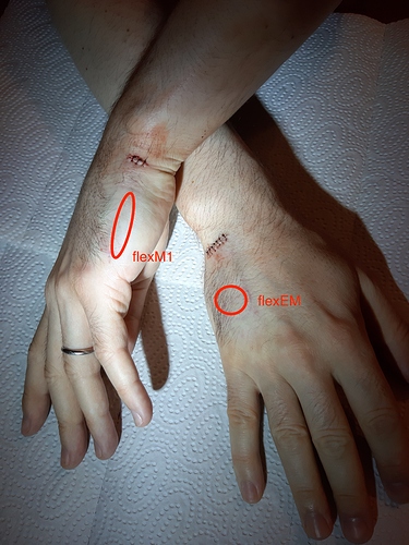 sutures_annotated